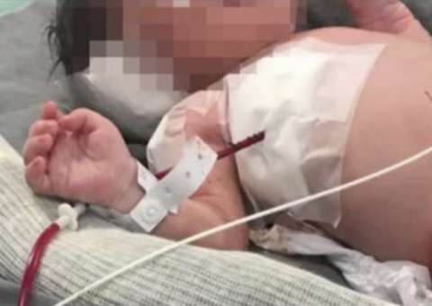 Morre o bebê Arthur, baleado dentro da barriga da mãe