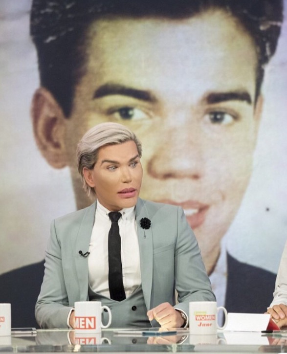  'Ken Humano' brasileiro mostra resultado de novas cirurgias plásticas