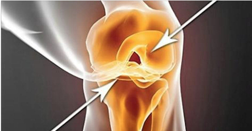 Essa bebida ajuda reconstruir cartilagem, ligamentos e acaba com dor nos joelhos