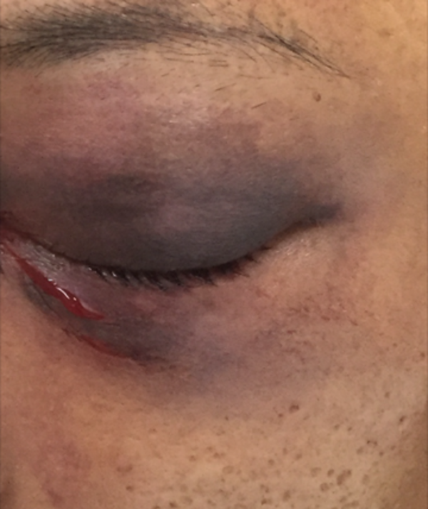 Em Manaus, homem é preso acusado de bater na ex-mulher a marteladas por não aceitar fim de relacionamento