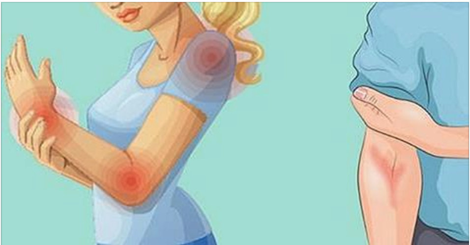 10 Sintomas que seu intestino está sobrecarregado de toxinas 