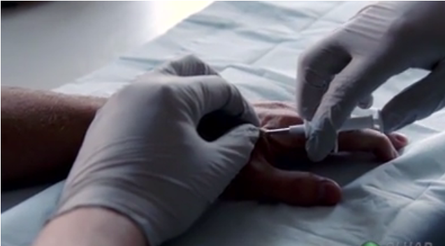 Polêmica: Empresas implantam chips em funcionários