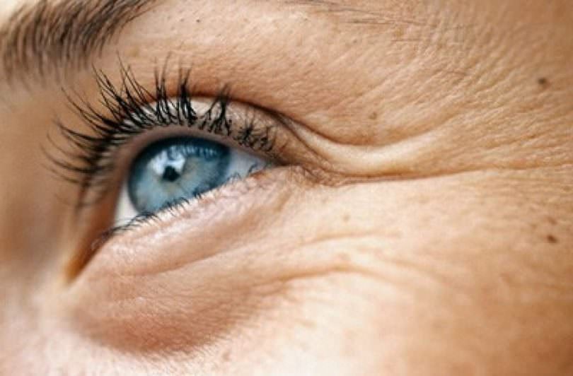 Elimine os pés de galinha do seu rosto com estas 6 dicas simples