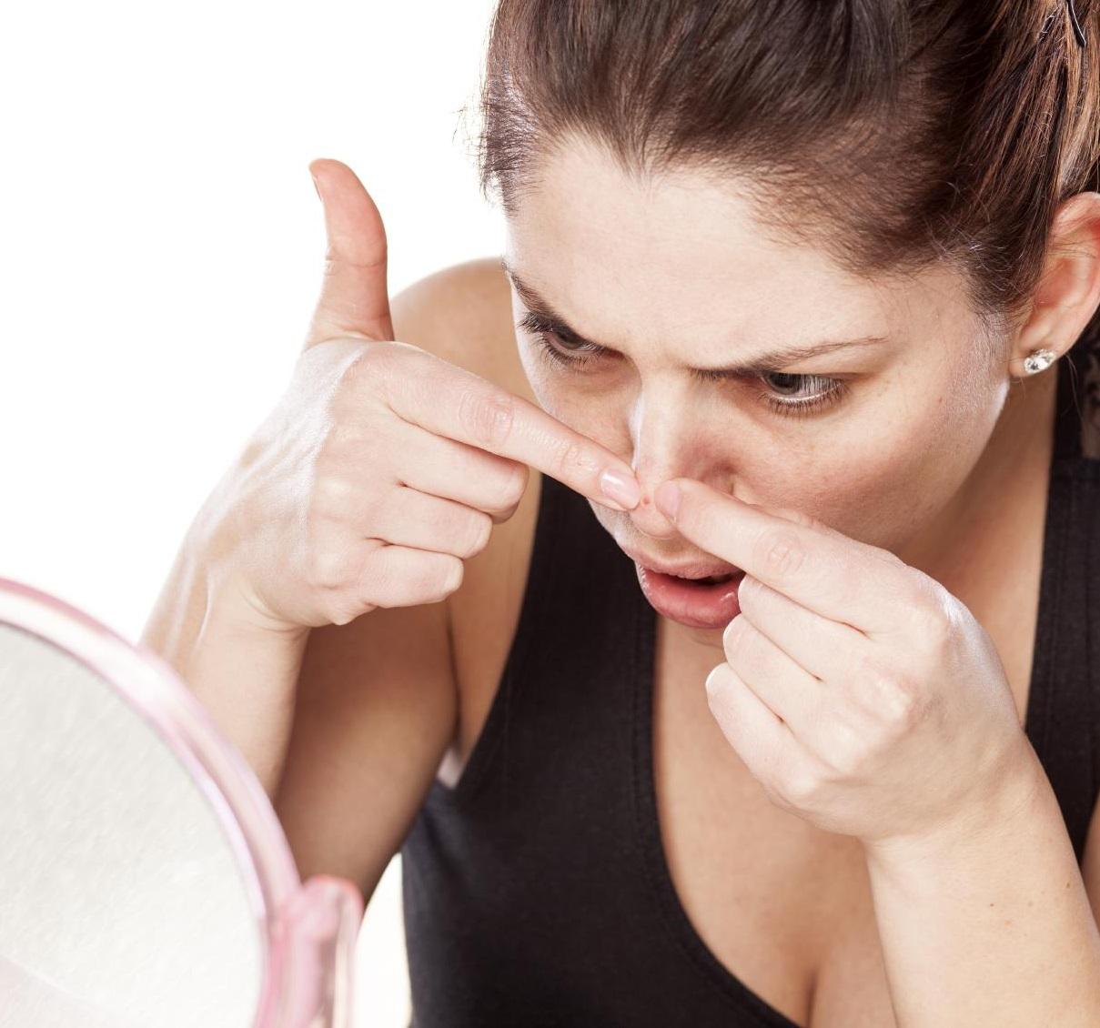 Mistura fácil com dois alimentos naturais promete acabar com os cravos na hora