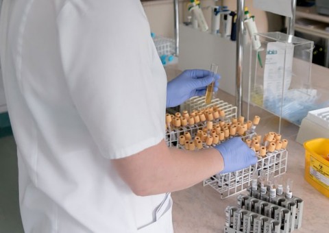 FVS monta estratégia para investigar casos de infecção viral no Amazonas