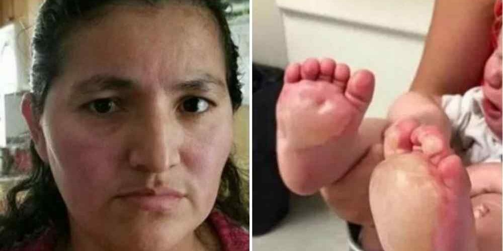 Babá se irrita com bebê de 6 meses e queima seus pés em frigideira quente