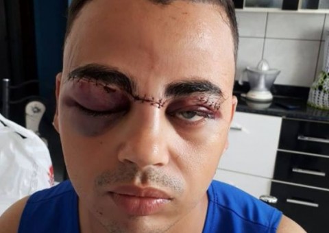 Jovem tem rosto cortado por cerol e expõe risco em rede social