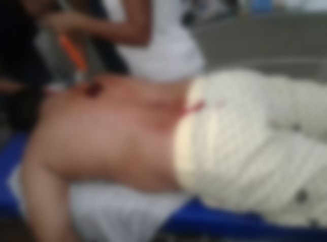 Homem é esfaqueado durante ceia de Natal e arma fica cravada nas costas