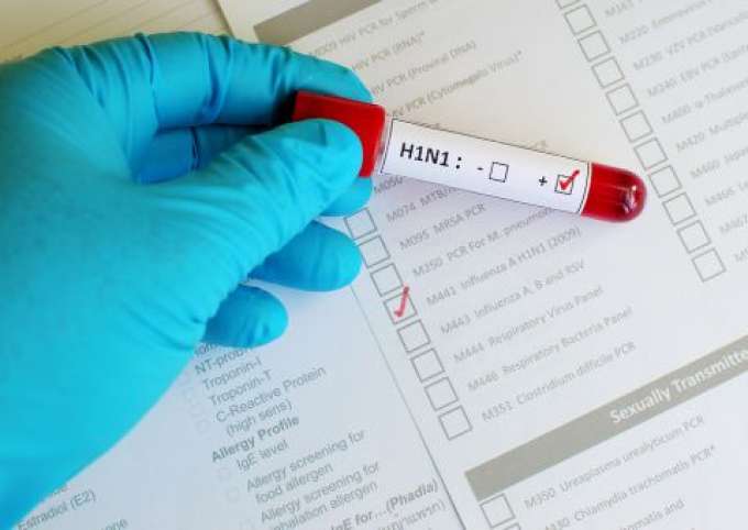 Seis pessoas são internadas por suspeita de gripe suína no Amazonas