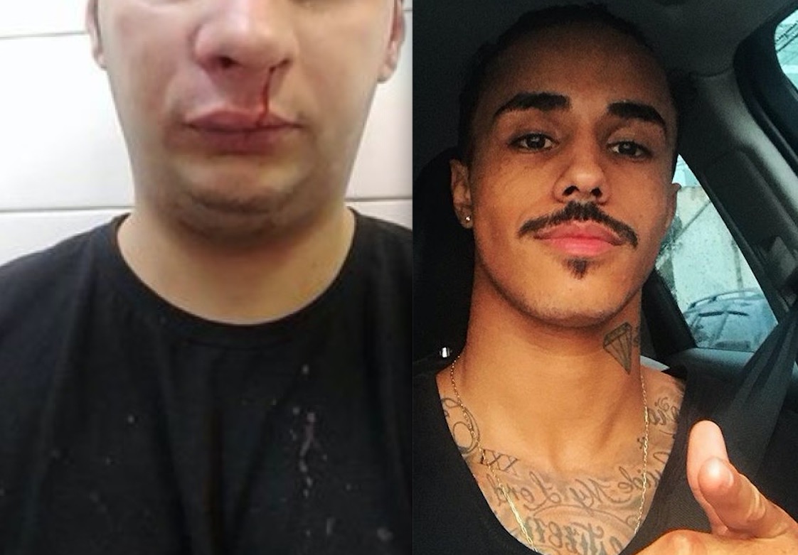 MC Livinho é acusado de agredir profissional apósshow 