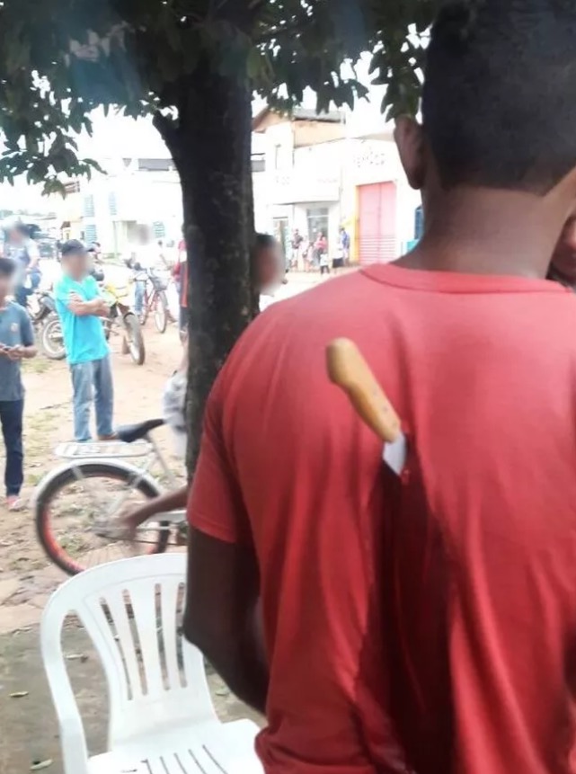 Novinho fica com faca gravada no meio das costas após ser atacado em bar