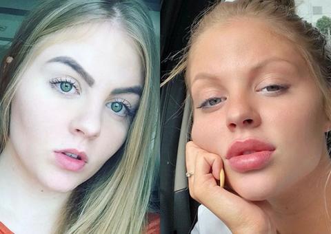 Mudanças no rosto de mulher de Whindersson Nunes chamam atenção; veja antes e depois