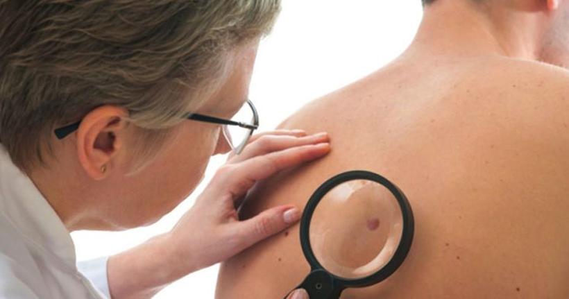 Fundação Alfredo da Matta oferta serviços dermatológicos em ação global neste sábado