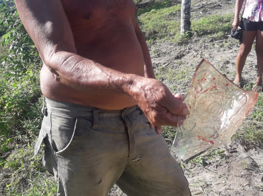 Em Manaus, criança de 8 anos morre ao cair sobre pedaço de vidro 