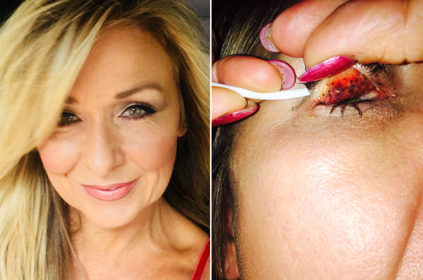 Com hábito de dormir maquiada, mulher quase fica cega após adquirir infecção grave