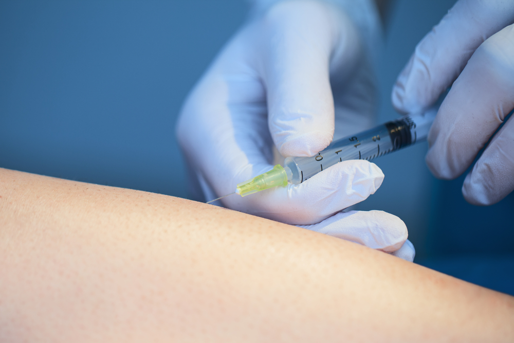 Associação médica alerta para riscos de tratamento contra varizes