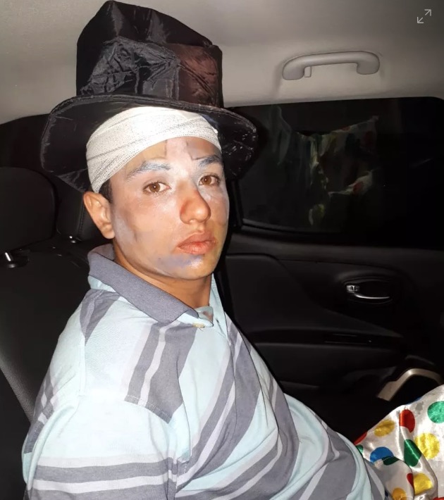 Vestido de palhaço, jovem invade casa da ex e agride família com azulejo