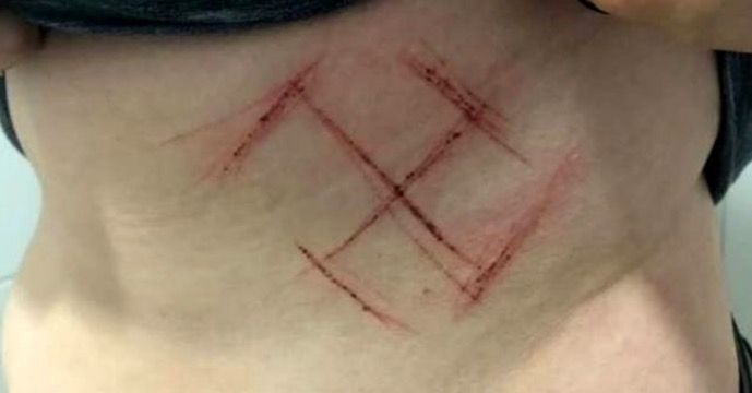  Delegado diz que suástica nazista marcada em jovem por apoiadores de Bolsonaro 'é símbolo budista'