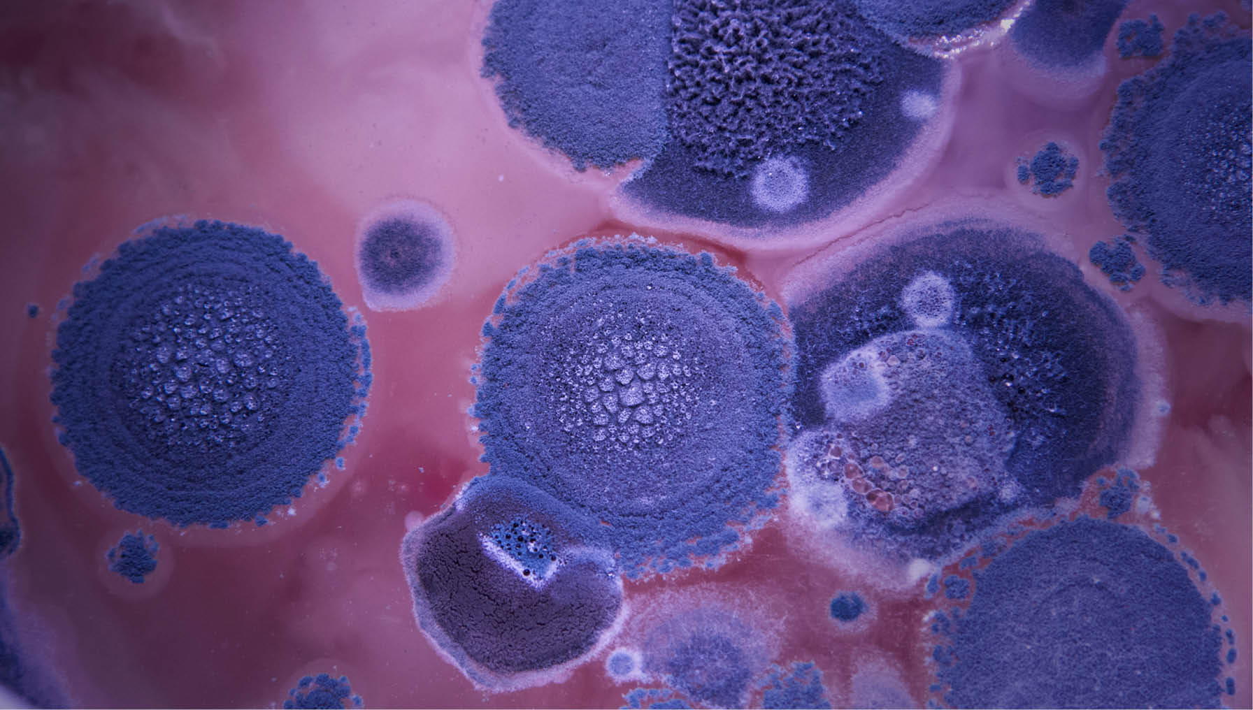 Infecções por superfungos devem se tornar mais comuns, diz pesquisador