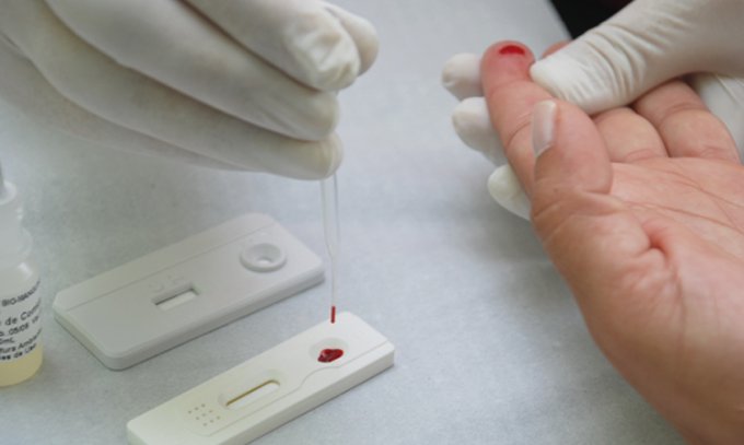 Ação oferta testes rápidos de HIV, hepatites e exame de turberculose em Manaus