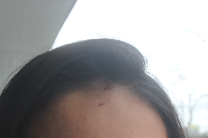 Jovem é agredida durante comemoração de natal no All Night 