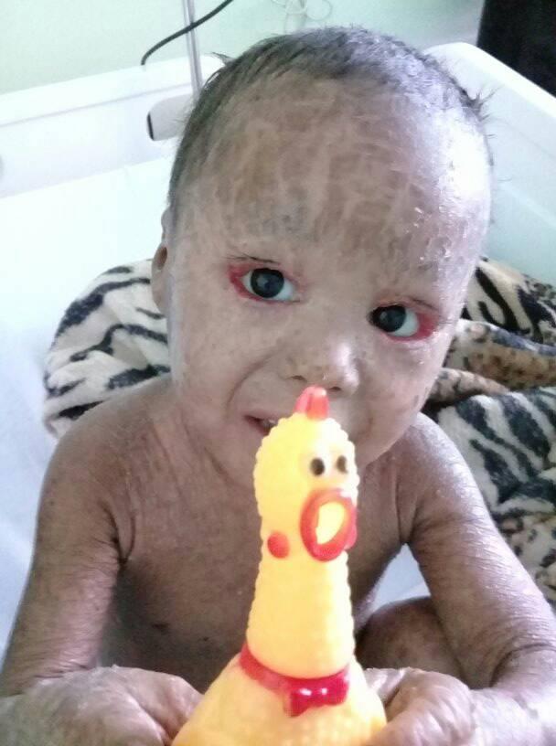 Em Manaus, família pede doações para menino com doença rara 