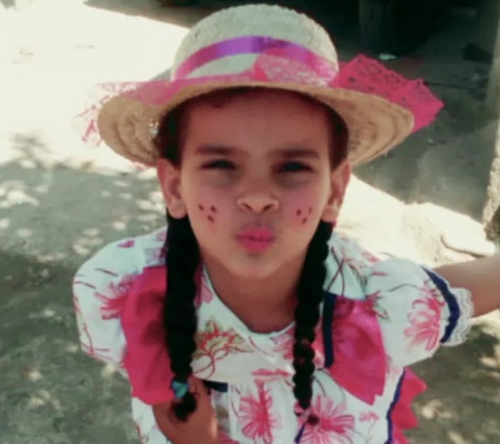 Criança que teve corpo queimado em vazamento de gasolina está em estado gravíssimo