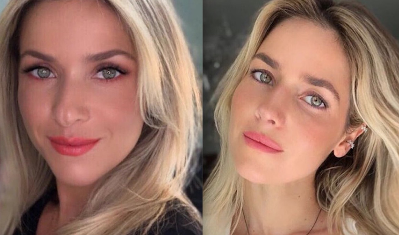 Monique Alfradique mostra resultado de cirurgia no nariz