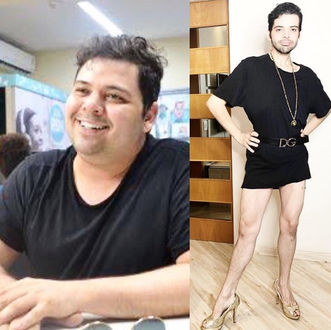 Gustavo Mendes mostra 'antes e depois' de perder 48 kg por cirurgia bariátrica