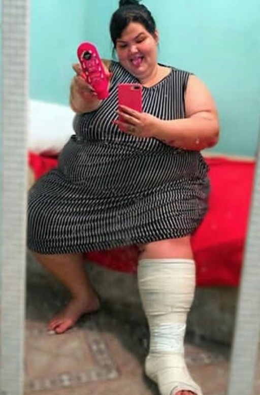  Após acidente, bailarina plus size volta a desabafar sobre falta de acessibilidade