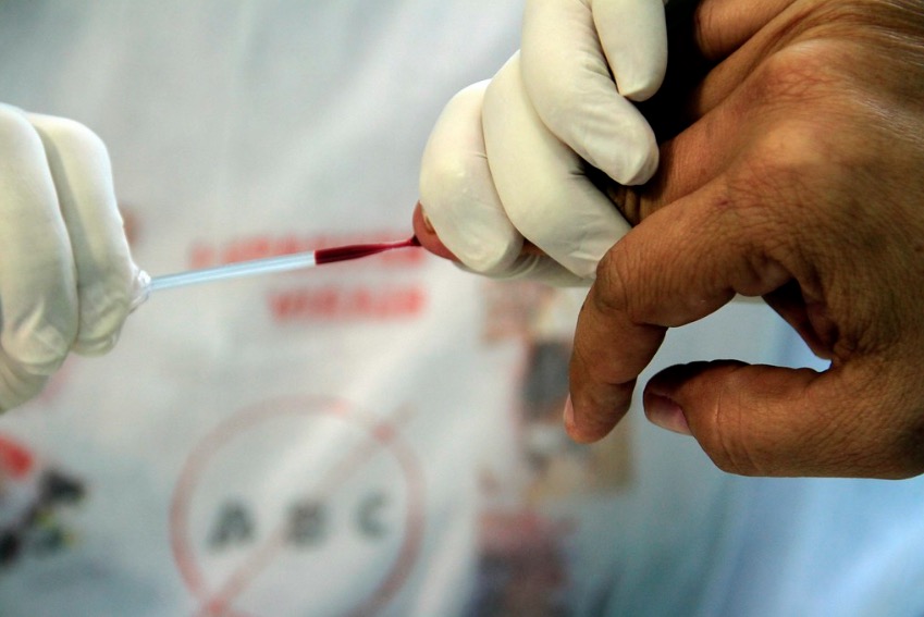 Ações de combate às hepatites virais são realizadas em Manaus