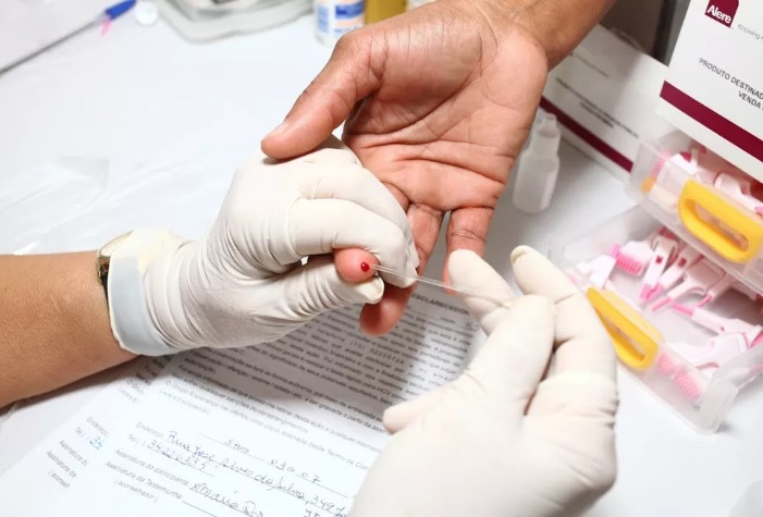 Testes gratuitos de hepatites virais serão realizados em Manaus 