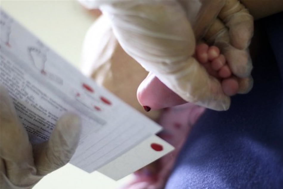 Susam inicia qualificação de profissionais para teste de pezinho