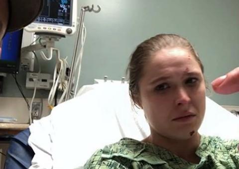 Ronda Rousey posta foto com parte do dedo pendurado após acidente em filmagem