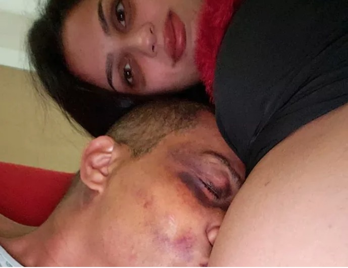 Após acidente, vocalista do Sampa Crew faz post emocionante e mostra hematomas 