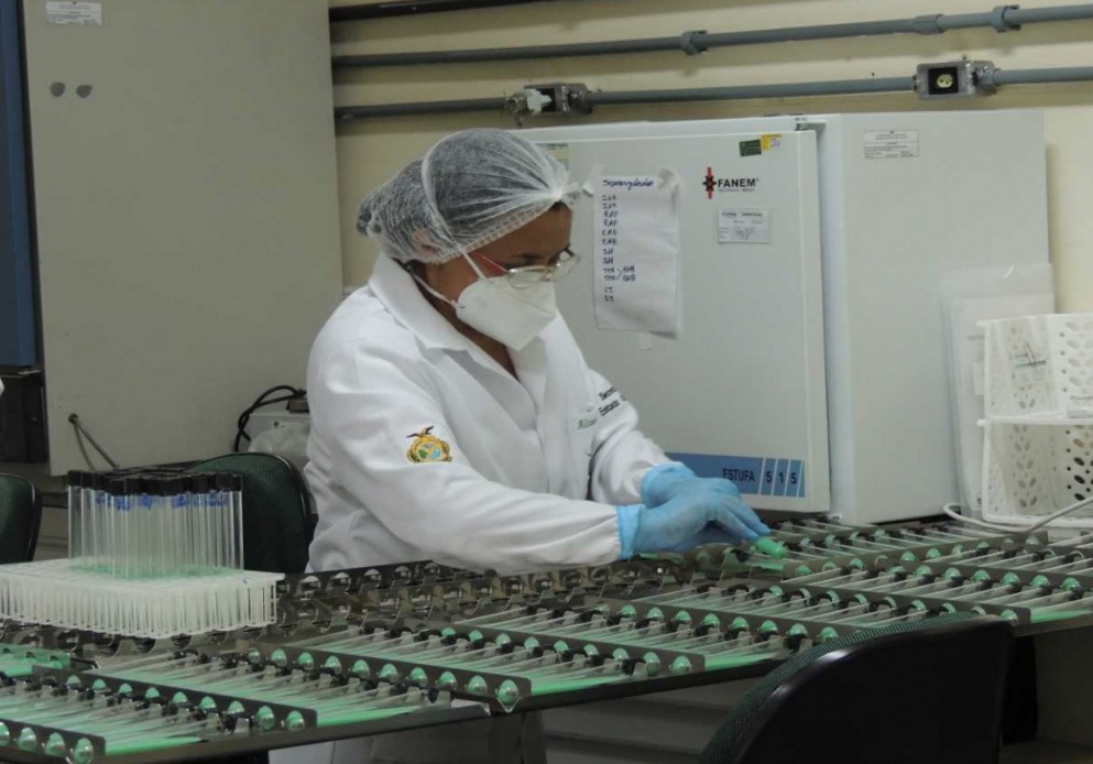 Laboratório do Amazonas se torna referência nacional em diagnóstico de tuberculose