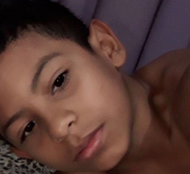 Criança sai de casa para brincar e é baleada na cabeça por colega de 13 anos em Manaus