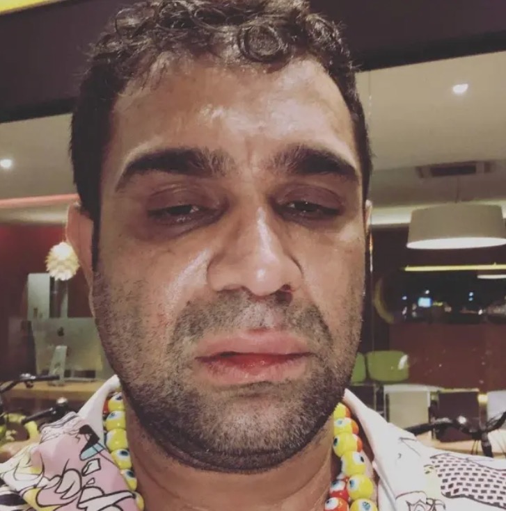 Evandro Santo relata que foi agredido após show em Marília