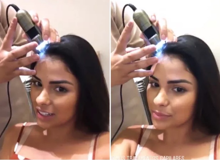 Ex-bbb Munik Nunes revela que está perdendo cabelos após cirurgia plástica