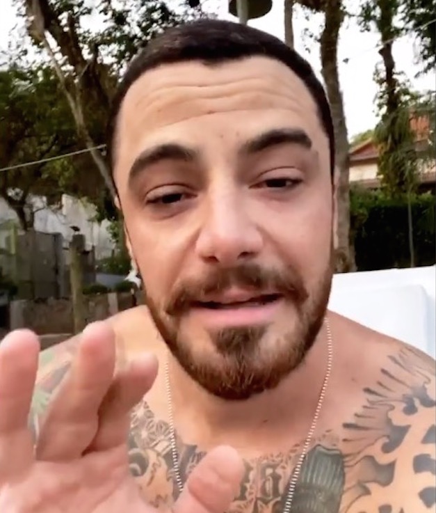 Felipe Titto é mordido por cachorro e leva 15 pontos na perna 