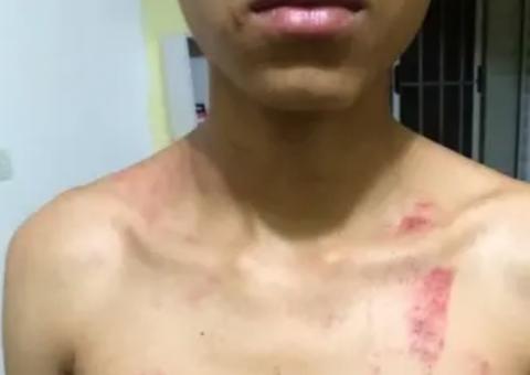 Jovem de 16 anos acusa sete seguranças da CPTM de espancamento