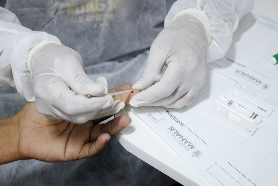 Oferta de testagem rápida para sífilis é intensificada em Manaus