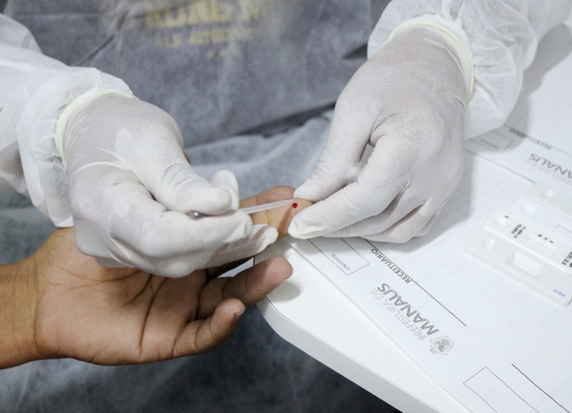 Prefeitura intensifica oferta de testagem rápida para sífilis em 155 Unidades de Saúde