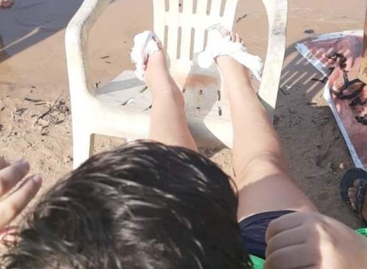 Criança perde parte do dedo ao ser atacada por piranhas em praia de Manaus