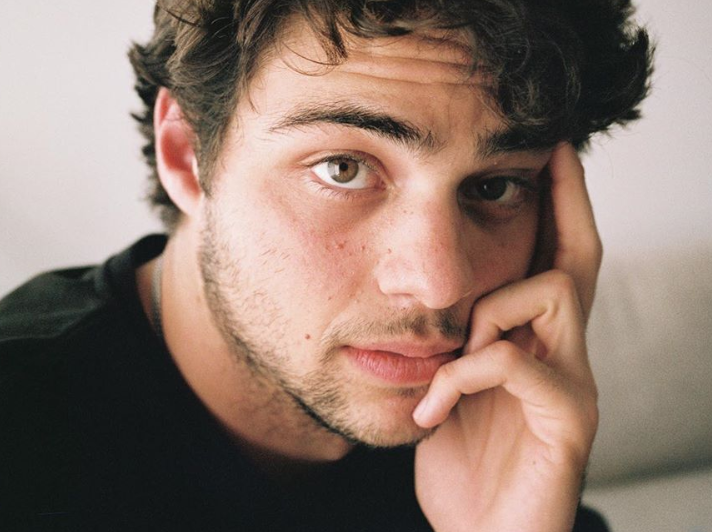 Noah Centineo revela que ficou cinco dias sem tomar banho após cirurgia 