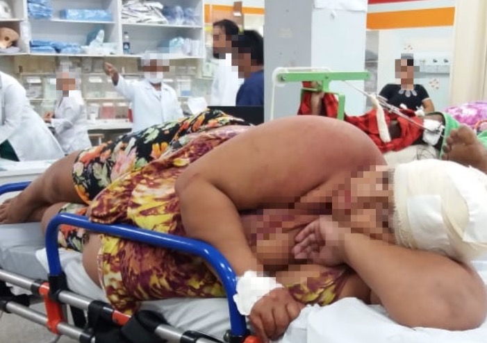 Grávida ferida em chacina está com bala alojada na cabeça em hospital de Manaus