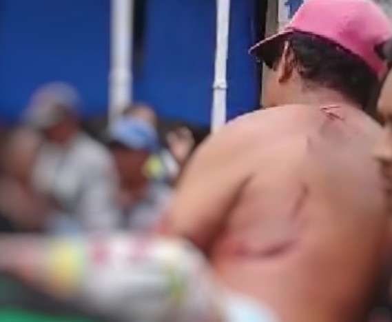 Ex-servidor público fica gravemente ferido ao ser atacado por jacaré no Amazonas