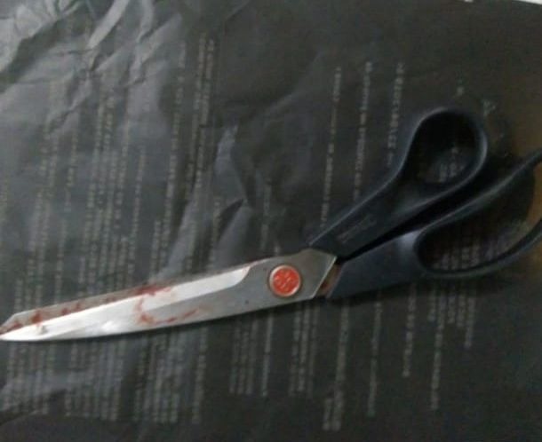 Homem fica em estado grave ao levar tesouradas de amigo em Manaus