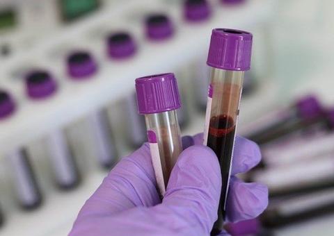 Paciente vítima de discriminação em UPA por ter HIV será indenizada