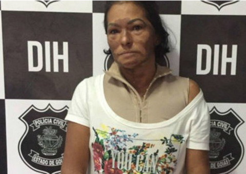 Mulher põe fogo no marido por não aceitar o fim do relacionamento